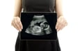 Advanced Maternal Age: Pregnancy After 35 image