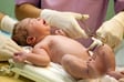 The Natural Cesarean image