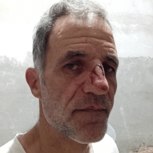Solidarity in the face of fascism: Updates from Gaza to SCOTUS
