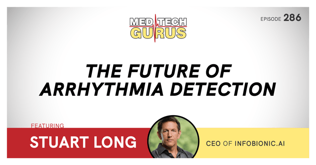 The Future of Arrhythmia Detection image