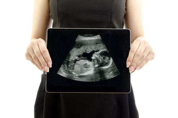Advanced Maternal Age: Pregnancy After 35 image