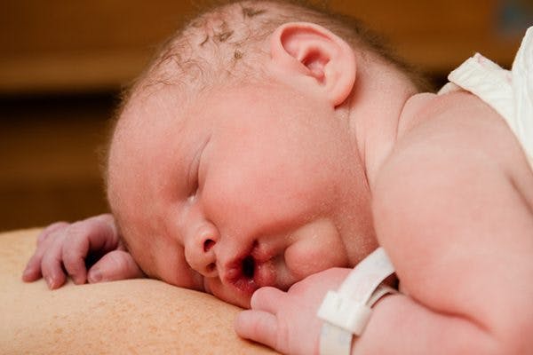 The Benefits of Kangaroo Care image