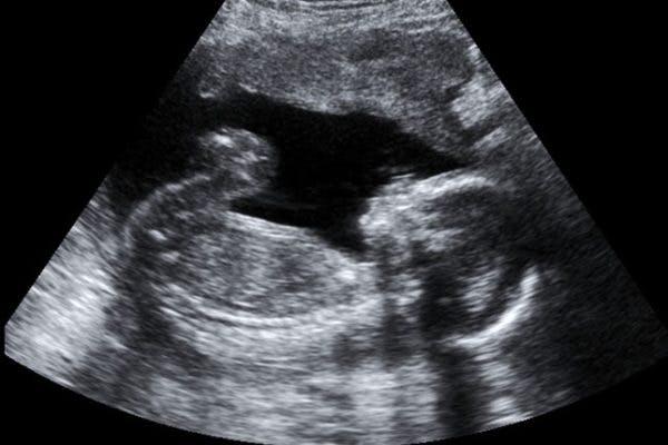 Seeking Support: Miscarriage and Infant Loss image