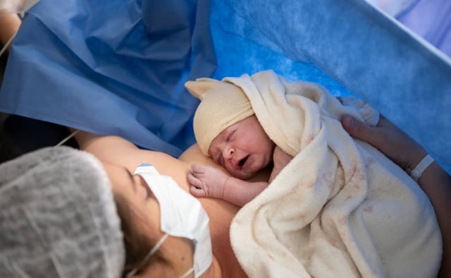 Preparing for Your Twin Cesarean Birth image