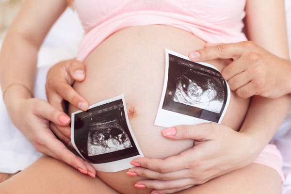 Trending Baby Names for Twins image