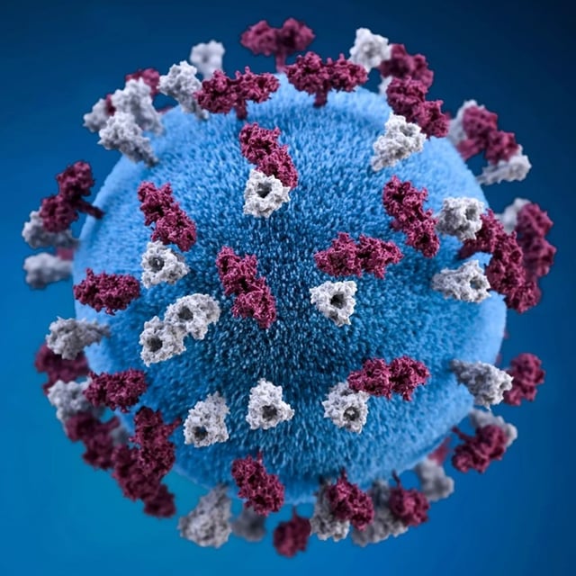 Alberta's measles catastrophe image