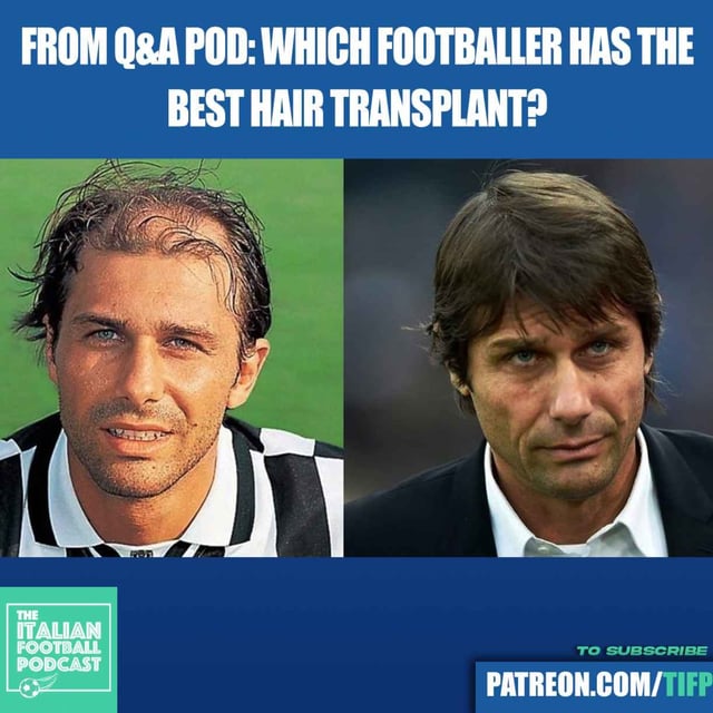 Which Footballer Has The Best Hair Transplant? From David Beckham To Antonio Conte image