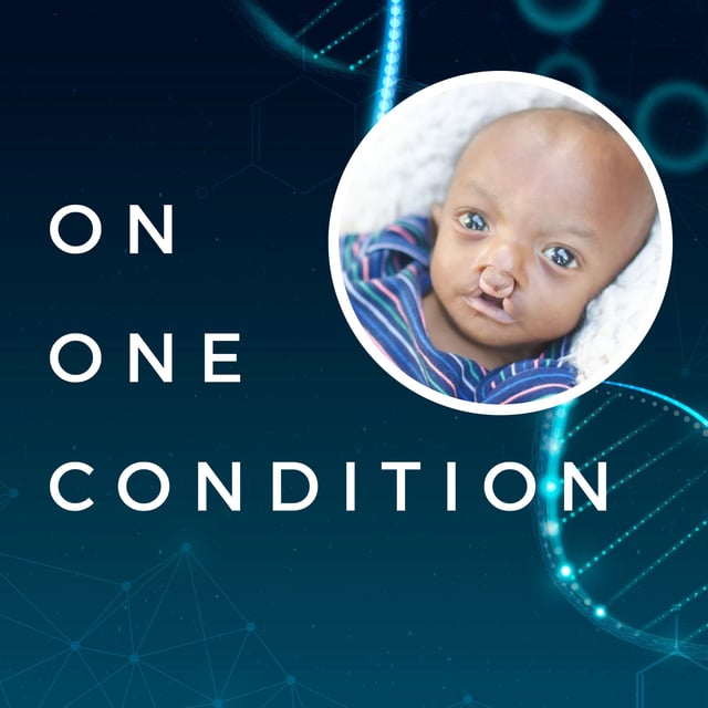Episode 63: Sarita Edwards - Trisomy 18 image