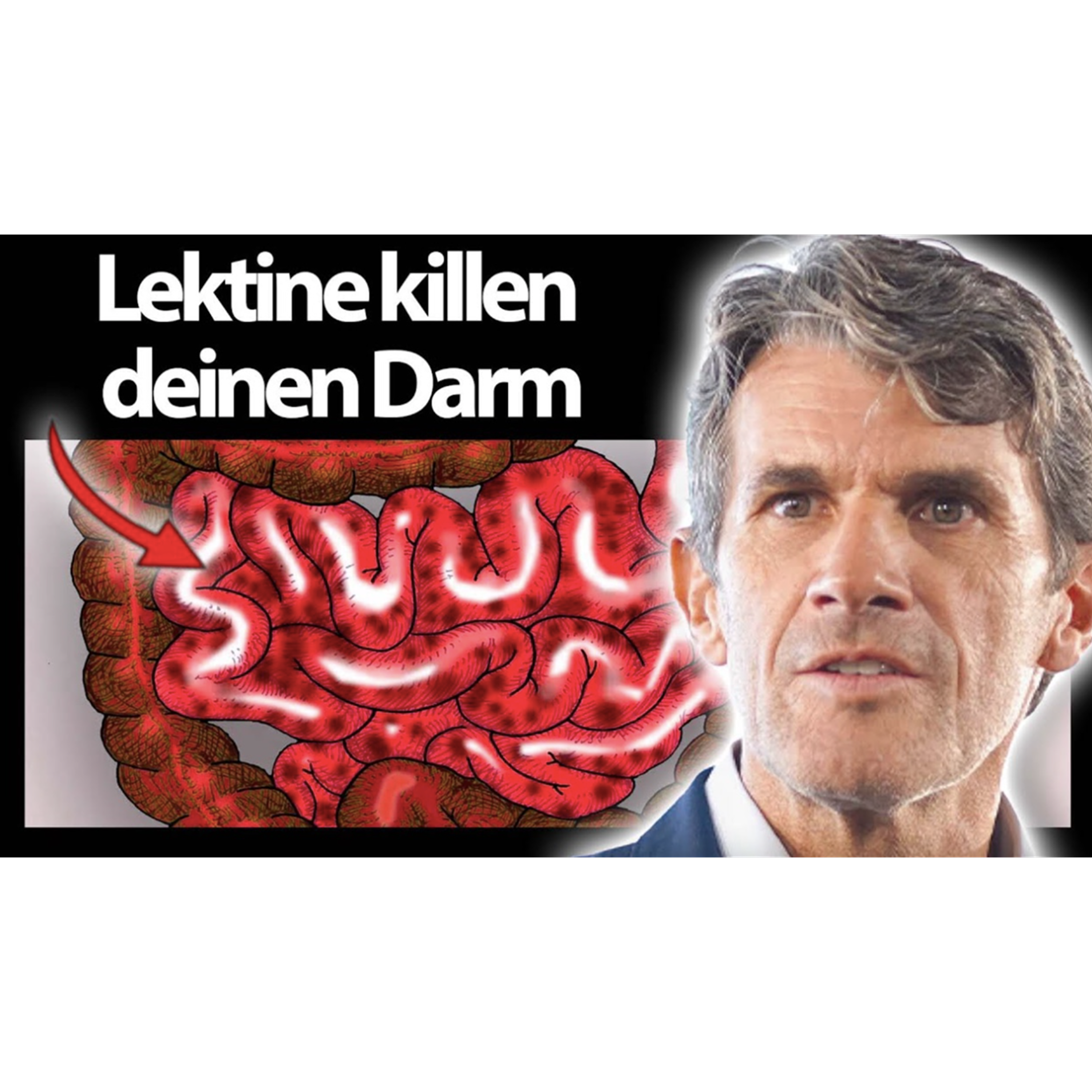 Lektine killen Deinen Darm I Dr. Ulrich Volz #1070