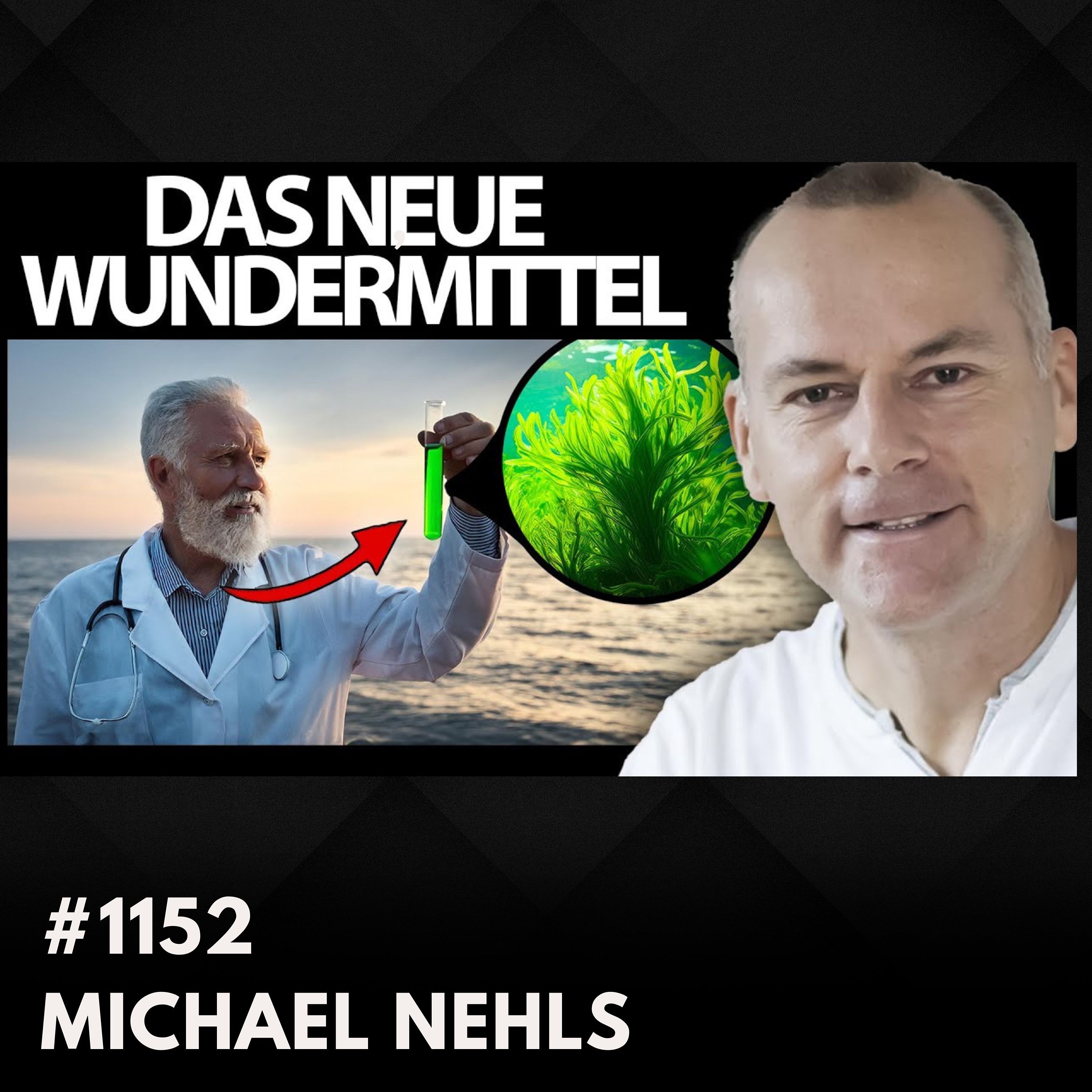 Diese Ernährung ist der Favorit von Omega-3 Papst. Dr. Michael Nehls #1152